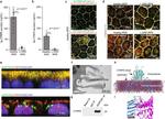 ATG5 Antibody in Immunohistochemistry (IHC)