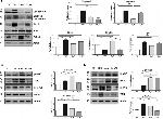 Tau Antibody in Western Blot (WB)