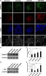 MAP2 Antibody in Immunocytochemistry (ICC/IF)