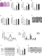 PPAR delta Antibody in Western Blot (WB)