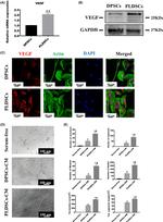 VEGF Antibody in Western Blot (WB)