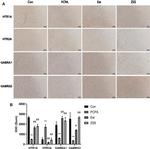 HTR2A Antibody in Immunohistochemistry (IHC)