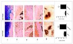 Tryptase Antibody in Immunohistochemistry (IHC)