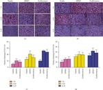 CD34 Antibody in Immunohistochemistry (IHC)