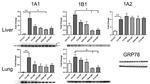 CYP1B1 Antibody in Western Blot (WB)