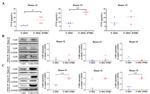 Calcium Sensing Receptor Antibody in Western Blot (WB)