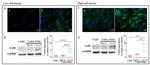 Calcium Sensing Receptor Antibody in Western Blot (WB)