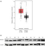 SOCS4 Antibody in Western Blot (WB)