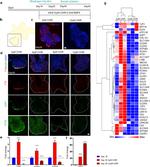 OTX2 Antibody in Immunohistochemistry (IHC)