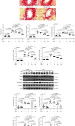 Fibronectin Antibody in Western Blot (WB)