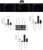 MC1R Antibody in Western Blot (WB)