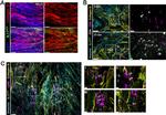 IL-17 A/F Antibody in Immunohistochemistry (IHC)