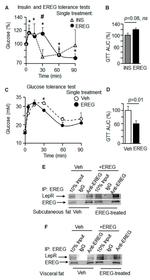 Leptin Receptor Antibody in Western Blot, Immunoprecipitation (WB, IP)