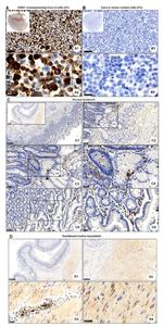 GPR68 Antibody in Immunohistochemistry (IHC)