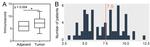 SPDL1 Antibody in Immunohistochemistry (IHC)