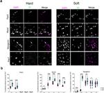 Myogenin Antibody in Immunohistochemistry (IHC)