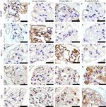 EXT1 Antibody in Immunohistochemistry (IHC)