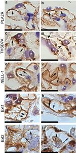 EXT1 Antibody in Immunohistochemistry (IHC)