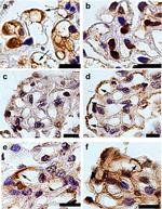 EXT1 Antibody in Immunohistochemistry (IHC)