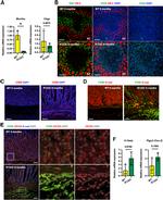 CD45 Antibody in Immunohistochemistry (IHC)