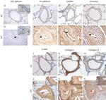 CD144 (VE-cadherin) Antibody in Immunohistochemistry (Paraffin) (IHC (P))