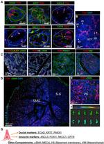 Claudin 1 Antibody in Immunohistochemistry (IHC)