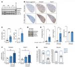 PSPH Antibody in Western Blot (WB)