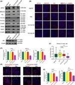 PKP3 Antibody in Western Blot, Immunocytochemistry (WB, ICC/IF)