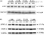 SERCA2 ATPase Antibody in Western Blot (WB)