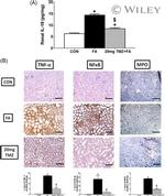 TNF alpha Antibody in Immunohistochemistry (IHC)