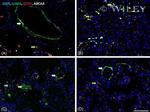 SFTPC Antibody in Immunohistochemistry (IHC)