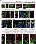 HuC/HuD Antibody in Immunohistochemistry (IHC)