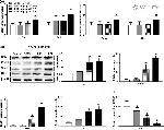 PTCH Antibody in Western Blot (WB)