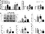 PTCH Antibody in Western Blot (WB)