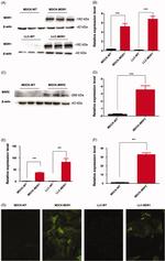 P-Glycoprotein Antibody in Western Blot (WB)