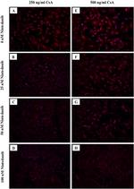 TGM2 Antibody in Immunocytochemistry (ICC/IF)