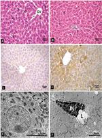 Bcl-2 Antibody in Immunohistochemistry (IHC)