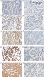 Metadherin Antibody in Immunohistochemistry (IHC)