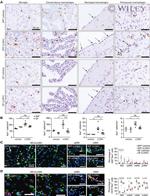 CD74 Antibody in Immunohistochemistry (IHC)