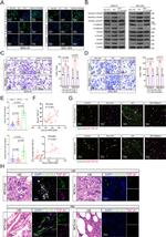 TGF beta-1 Antibody in Immunohistochemistry (IHC)