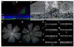 Rhodopsin Antibody in Immunohistochemistry (IHC)