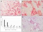 CD271 (NGF Receptor) Antibody in Immunohistochemistry (IHC)