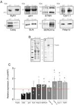 SERCA1 ATPase Antibody in Western Blot (WB)