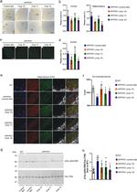 Tau Antibody in Western Blot (WB)