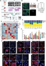 MCT2 Antibody in Immunohistochemistry (IHC)