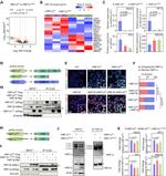 TCF2 Antibody in Immunoprecipitation (IP)