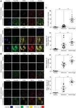 TNF alpha Antibody in Immunohistochemistry (Paraffin) (IHC (P))