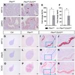 Cytokeratin 14 Antibody in Immunohistochemistry (IHC)