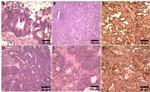 PTK7 Antibody in Immunohistochemistry (IHC)