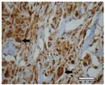 PCNA Antibody in Immunohistochemistry (IHC)